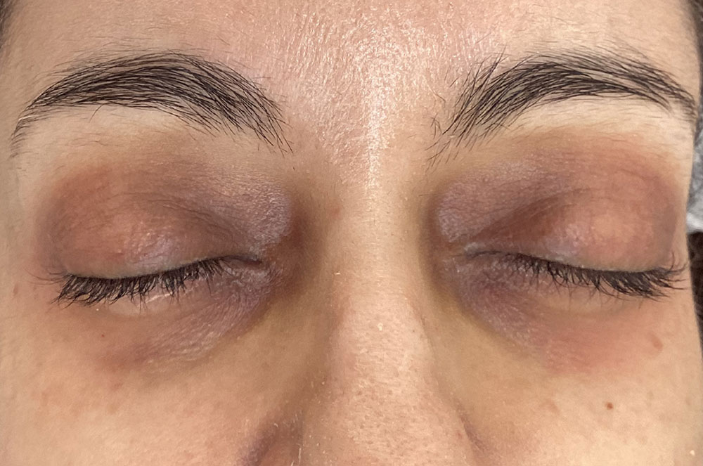 NanoSoft Eye After